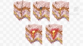 表皮层结构图素材67 免抠图片